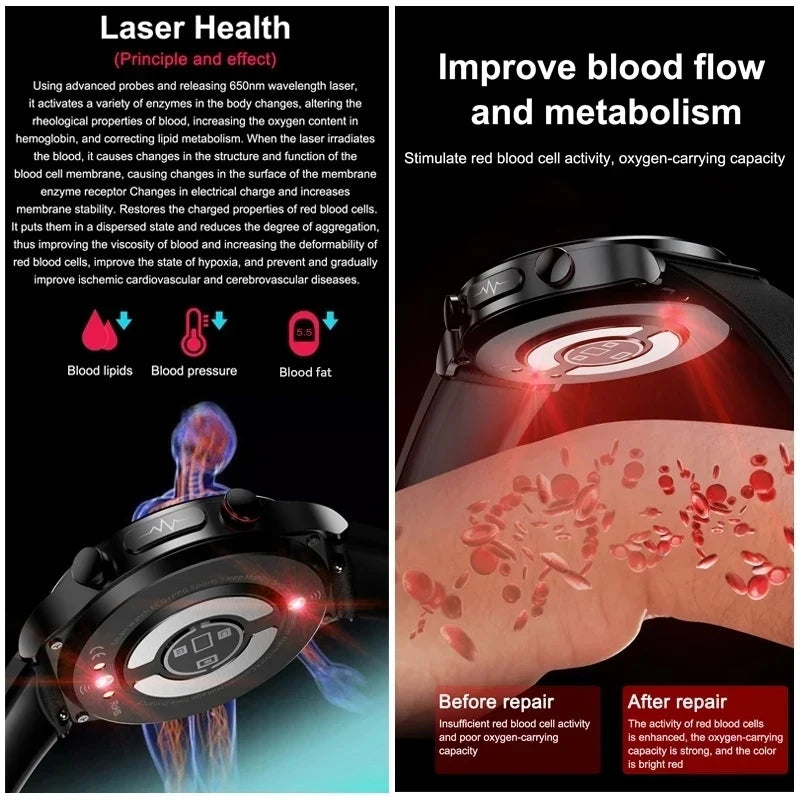 Veltrix® – Corelase X | Biomedical Smartwatch with Uric Acid & Body Fat Tracking, Laser Therapy, ECG+PPG & Bluetooth Calling